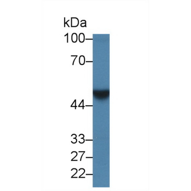 LIM Domain Binding Protein 1 (LDB1) Human Polyclonal Antibody
