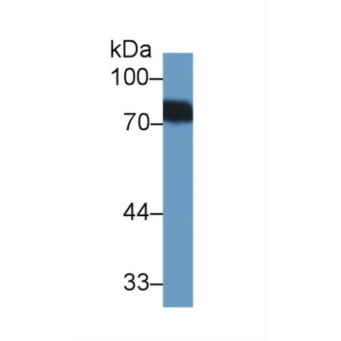 Biotinidase (BTD) Human Polyclonal Antibody
