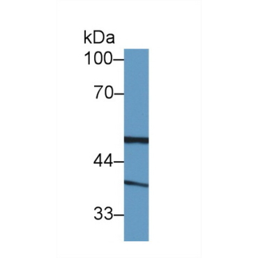 Biliverdin Reductase A (BLVRA) Human Polyclonal Antibody
