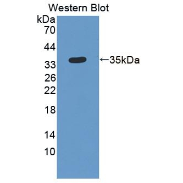 Bridging Integrator 1 (BIN1) Human Polyclonal Antibody