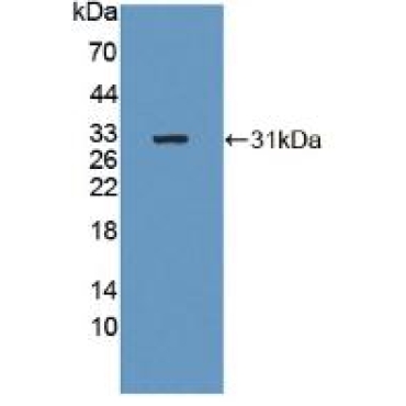 Beta-1,4-N-Acetyl Galactosaminyl Transferase 2 (b4GALNT2) Human Polyclonal Antibody