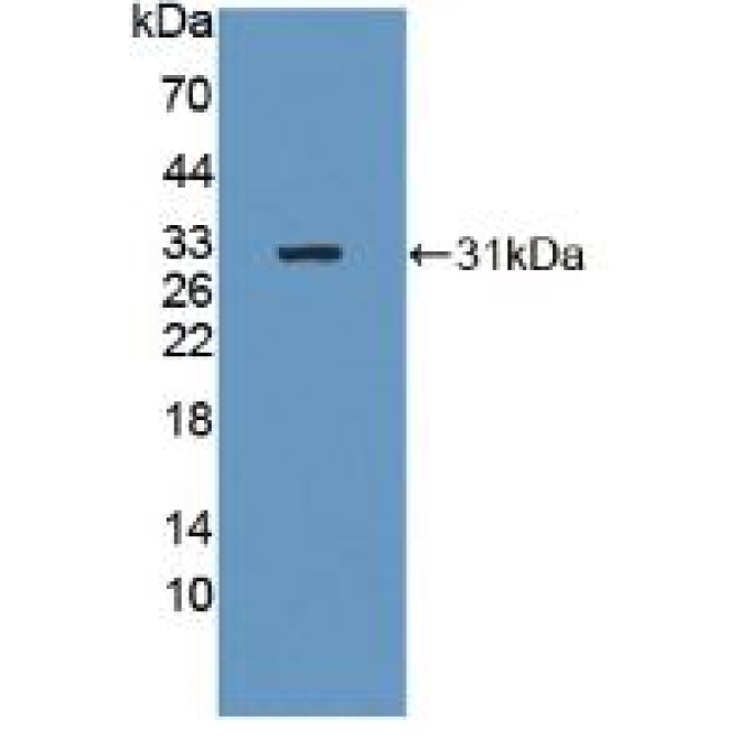 Beta-1,4-N-Acetyl Galactosaminyl Transferase 2 (b4GALNT2) Human Polyclonal Antibody