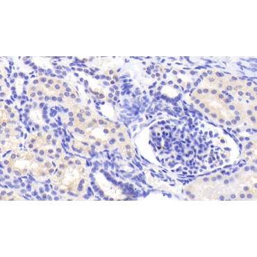 Artemin (ARTN) Human Polyclonal Antibody