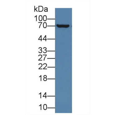 Acyloxyacyl Hydrolase (AOAH) Human Polyclonal Antibody