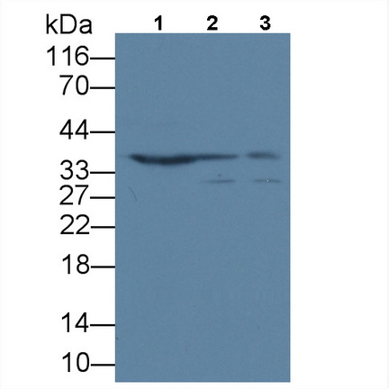 Acidic Nuclear Phosphoprotein 32 Family, Member A (ANP32A) Human Polyclonal Antibody
