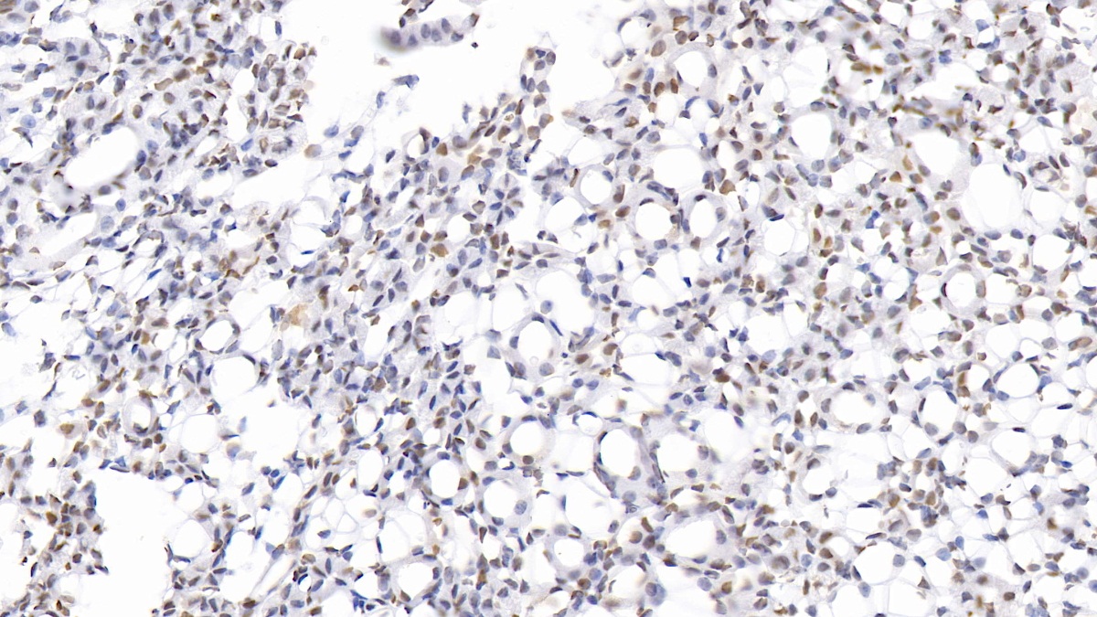 Acidic Nuclear Phosphoprotein 32 Family, Member A (ANP32A) Mouse Polyclonal Antibody