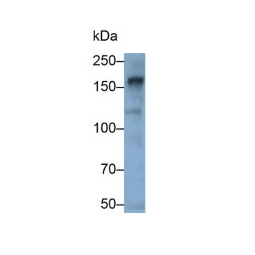 Anillin (ANLN) Human Polyclonal Antibody