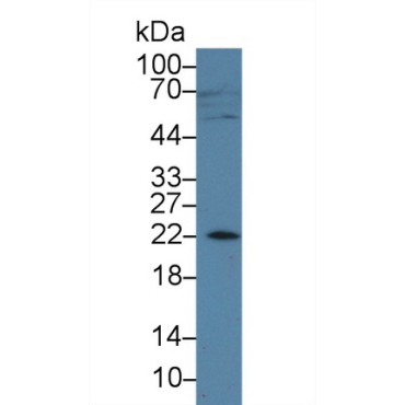 Amelogenin, X-Linked (AMELX) Human Polyclonal Antibody
