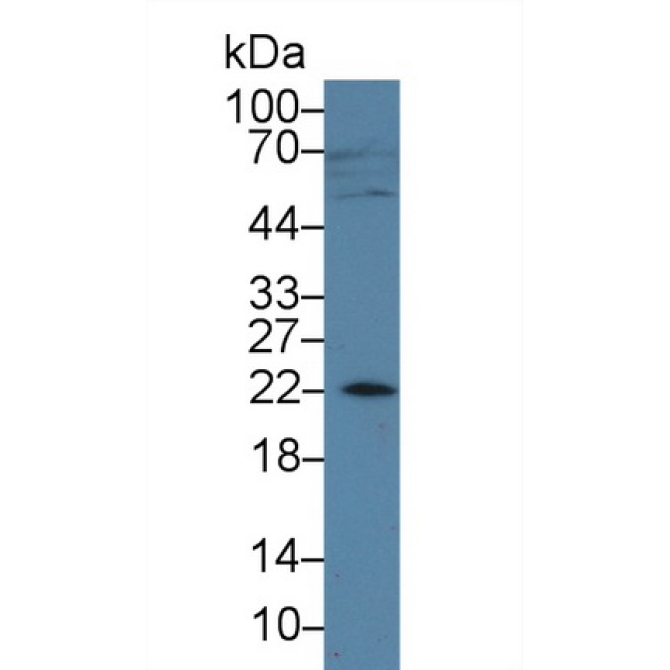 Amelogenin, X-Linked (AMELX) Human Polyclonal Antibody