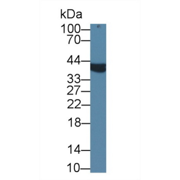 Alpha-Methylacyl Coenzyme A Racemase (aMACR) Human Polyclonal Antibody