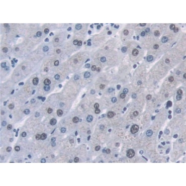 Desmoyokin (AHNAK) Human Polyclonal Antibody