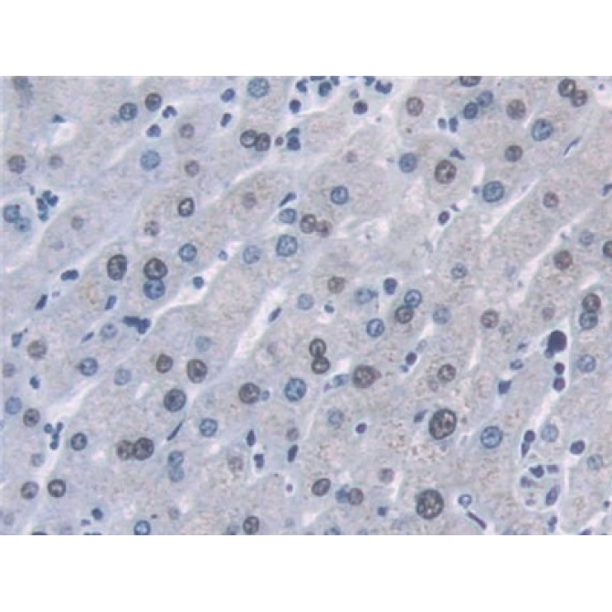 Desmoyokin (AHNAK) Human Polyclonal Antibody