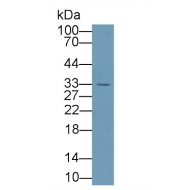 Agmatine Ureohydrolase (AGMAT) Human Polyclonal Antibody