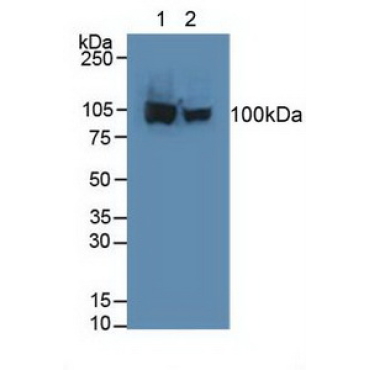 Aconitase 1 (ACO1) Human Polyclonal Antibody