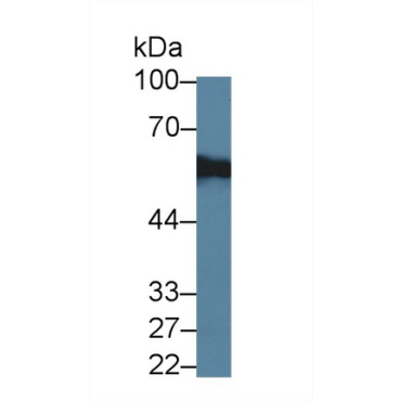 Abl Interactor 1 (ABI1) Human Polyclonal Antibody