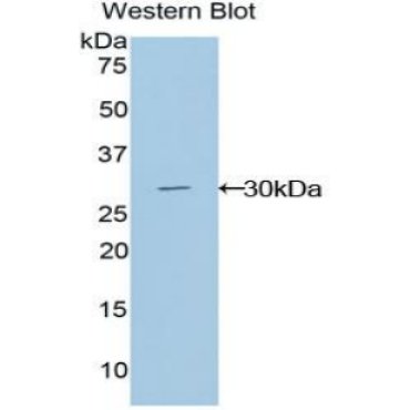 GLI Family Zinc Finger Protein 3 (GLI3) Human Polyclonal Antibody