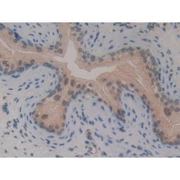 GLI Family Zinc Finger Protein 3 (GLI3) Mouse Polyclonal Antibody