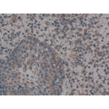 Golgi Glycoprotein 1 (GLG1) Human Polyclonal Antibody