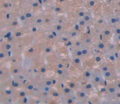 GLI Family Zinc Finger Protein 1 (GLI1) Rat Polyclonal Antibody