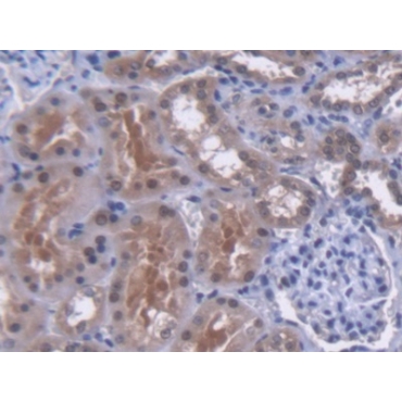 MutY Homolog (MUTYH) Human Polyclonal Antibody