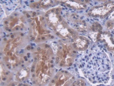 MutY Homolog (MUTYH) Human Polyclonal Antibody