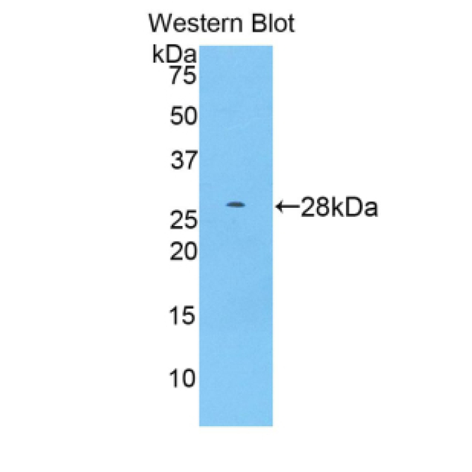A Disintegrin And Metalloprotease 15 (ADAM15) Human Polyclonal Antibody