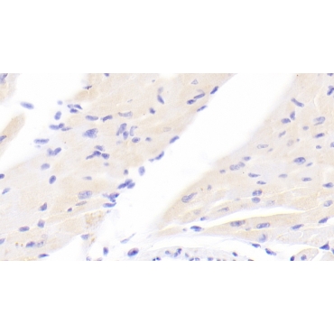 Inhibitor Of Kappa-Light Polypeptide Gene Enhancer In B-Cells Kinase Beta (IkBKb) Mouse Polyclonal Antibody
