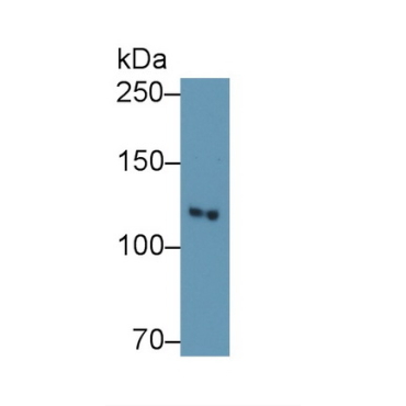 Phosphoinositide-3-Kinase Catalytic Beta Polypeptide (PIK3Cb) Human Polyclonal Antibody
