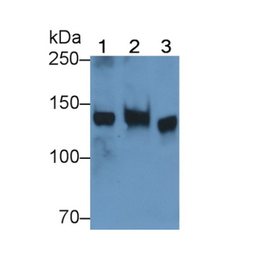 Phosphoinositide-3-Kinase Catalytic Beta Polypeptide (PIK3Cb) Human Polyclonal Antibody
