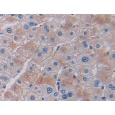 Phosphoinositide-3-Kinase Catalytic Beta Polypeptide (PIK3Cb) Human Polyclonal Antibody