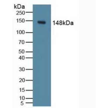 Phosphoinositide-3-Kinase Catalytic Delta Polypeptide (PIK3Cd) Human Polyclonal Antibody