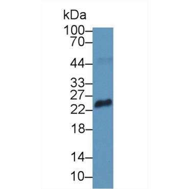 Retinoschisin (RS) Human Polyclonal Antibody