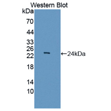 Achaete Scute Complex Like Protein 1 (ASCL1) Human Polyclonal Antibody