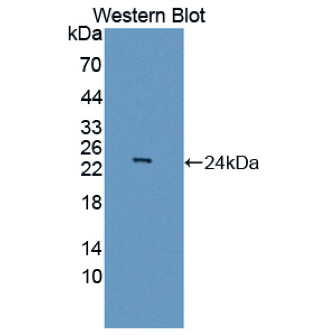 Achaete Scute Complex Like Protein 1 (ASCL1) Human Polyclonal Antibody
