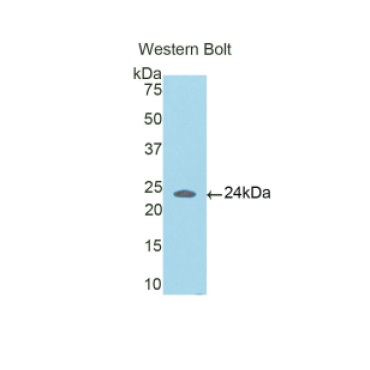 Coiled Coil Domain Containing Protein 80 (CCDC80) Human Polyclonal Antibody