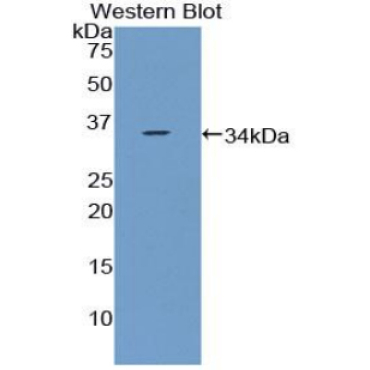 Coiled Coil Domain Containing Protein 80 (CCDC80) Human Polyclonal Antibody