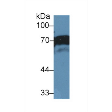 Numb Homolog (NUMB) Human Polyclonal Antibody