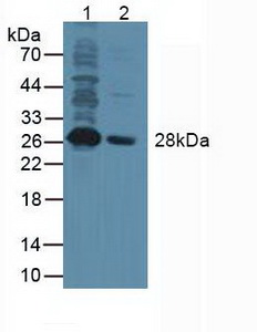 NANOG Homeobox Protein (NANOG) Human Polyclonal Antibody