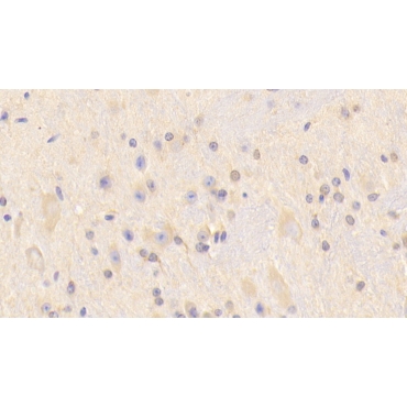 Carnosine Synthase 1 (CARNS1) Mouse Polyclonal Antibody
