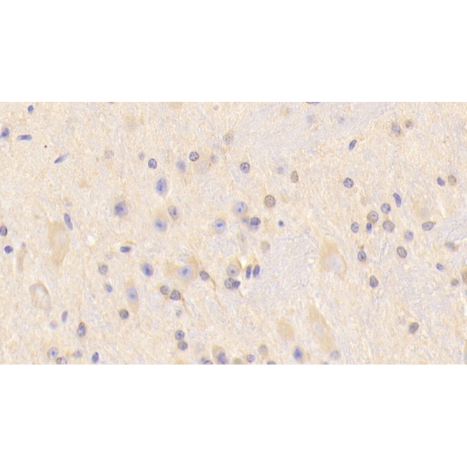 Carnosine Synthase 1 (CARNS1) Mouse Polyclonal Antibody