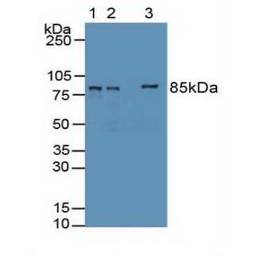 Enhancer Of Zeste Homolog 2 (EZH2) Human Polyclonal Antibody