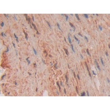 Fas Associating Death Domain Containing Protein (FADD) Human Polyclonal Antibody