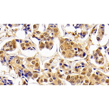 DNA Repair Protein RAD50 (RAD50) Human Polyclonal Antibody
