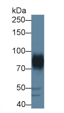 A Disintegrin And Metalloprotease 22 (ADAM22) Human Polyclonal Antibody