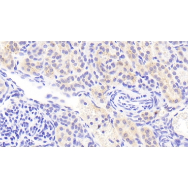 Leucine Rich Repeat LGI Family, Member 3 (LGI3) Human Polyclonal Antibody