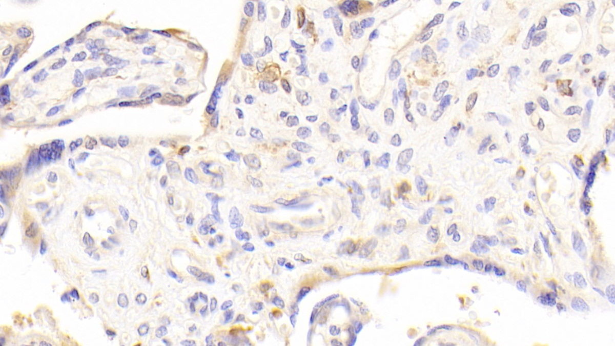 C1q And Tumor Necrosis Factor Related Protein 1 (C1QTNF1) Human Polyclonal Antibody