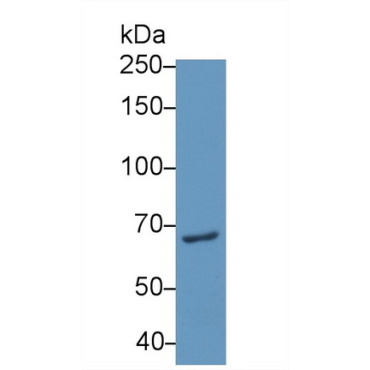 Pescadillo Homolog 1 (PES1) Human Polyclonal Antibody