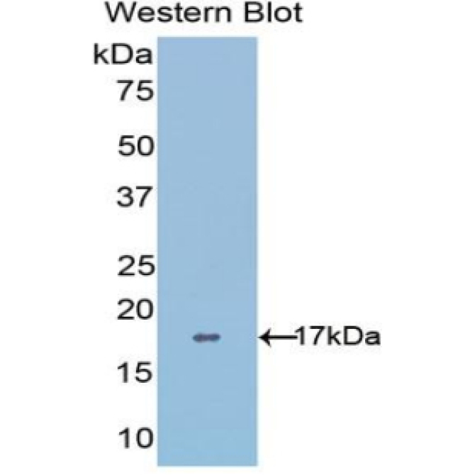 A Disintegrin And Metalloproteinase With Thrombospondin 4 (ADAMTS4) Human Polyclonal Antibody