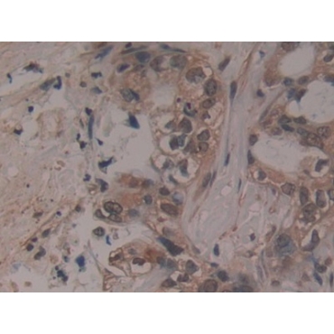 A Disintegrin And Metalloproteinase With Thrombospondin 5 (ADAMTS5) Human Polyclonal Antibody