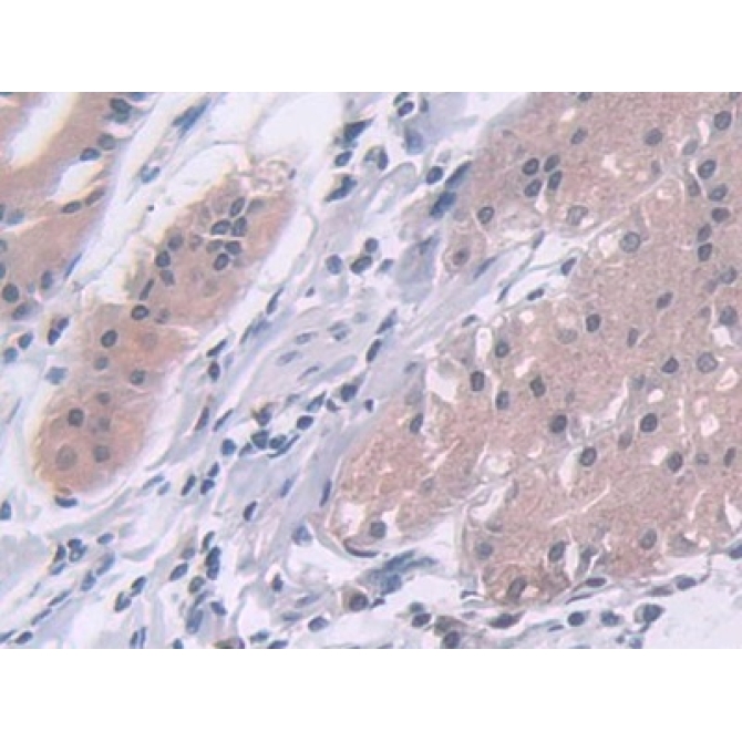 A Disintegrin And Metalloproteinase With Thrombospondin 10 (ADAMTS10) Human Polyclonal Antibody